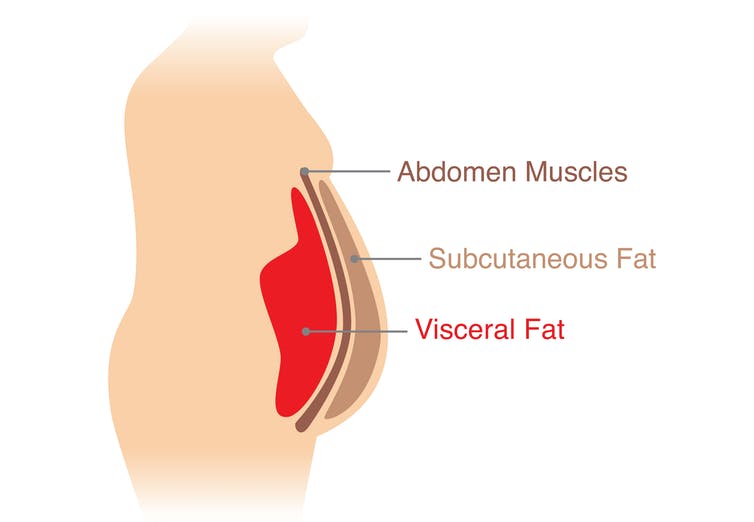 A diagram depicting a cross-section of the layers of tissue in the abdomen (abdomen muscles, subcutaneous fat, visceral fat)